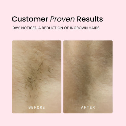 Women's Painless Bikini Trimmer & Shaver